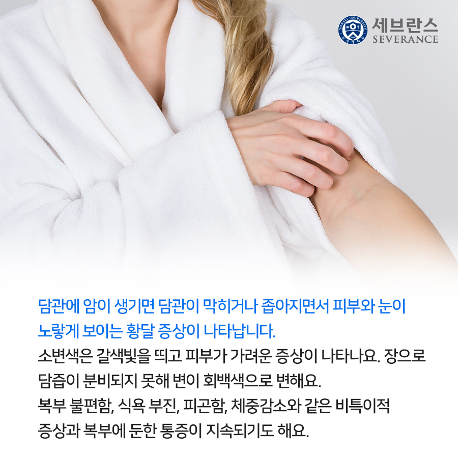 담관에 암이 생기면 담관이 막히거나 좁아지면서 피부와 눈이 노랗게 보이는 황달 증상이 나타납니다. 소변색은 갈색빛을 띄고 피부가 가려운 증상이 나타나요. 장으로 담즙이 분비되지 못해 변이 회백색으로 변해요.  복부 불편함, 식욕 부진, 피곤함, 체중감소와 같은 비특이적 증상과 복부에 둔한 통증이 지속되기도 해요.